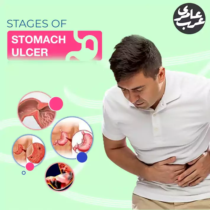 علائم زخم معده و روشهای درمان