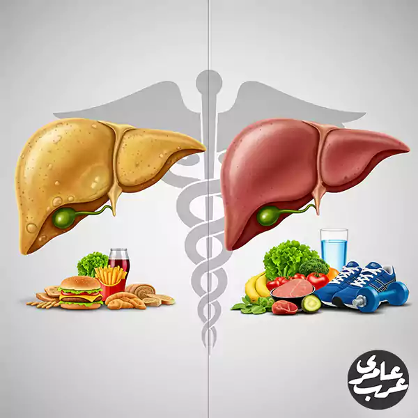 عرب عامری درمان کبد چرب: راهنمای کامل از راهکارهای پزشکی تا معجزات خانگی