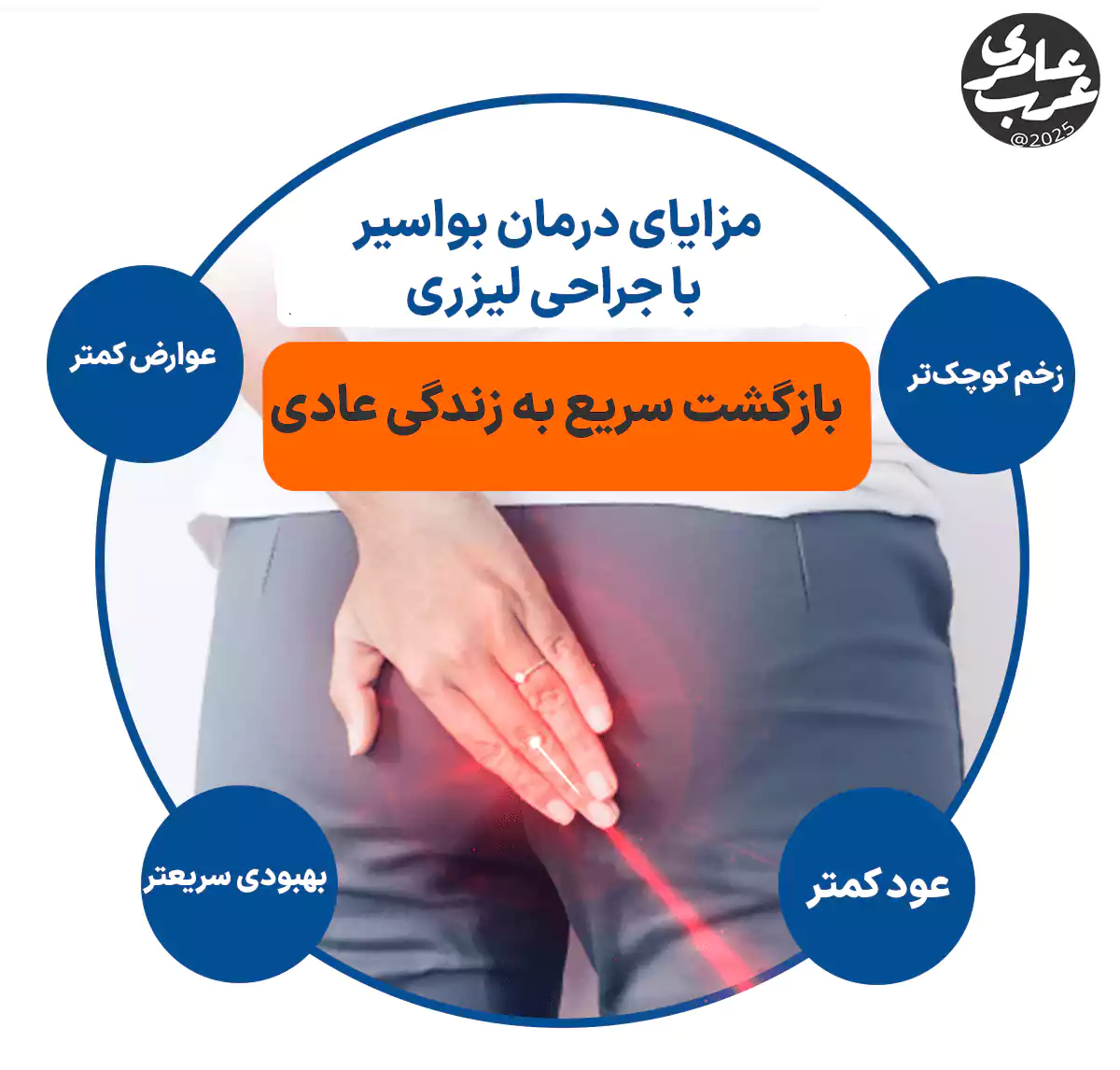 لیزر بواسیر یکی از جدیدترین و مؤثرترین روشهای درمان این بیماری است